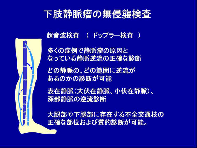 下肢静脈瘤血管内焼灼術